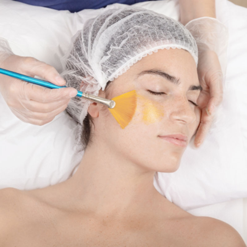 peeling-facial